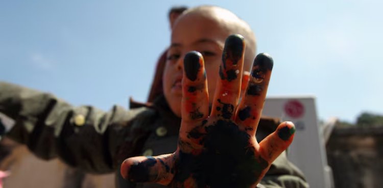 Researchers eye potential Down syndrome fix via advanced gene editing